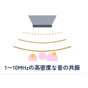 細胞｜オプティル（最新ldm）①